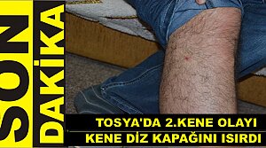 Tosya’da Yılın 2. Kene Olayı Yaşandı